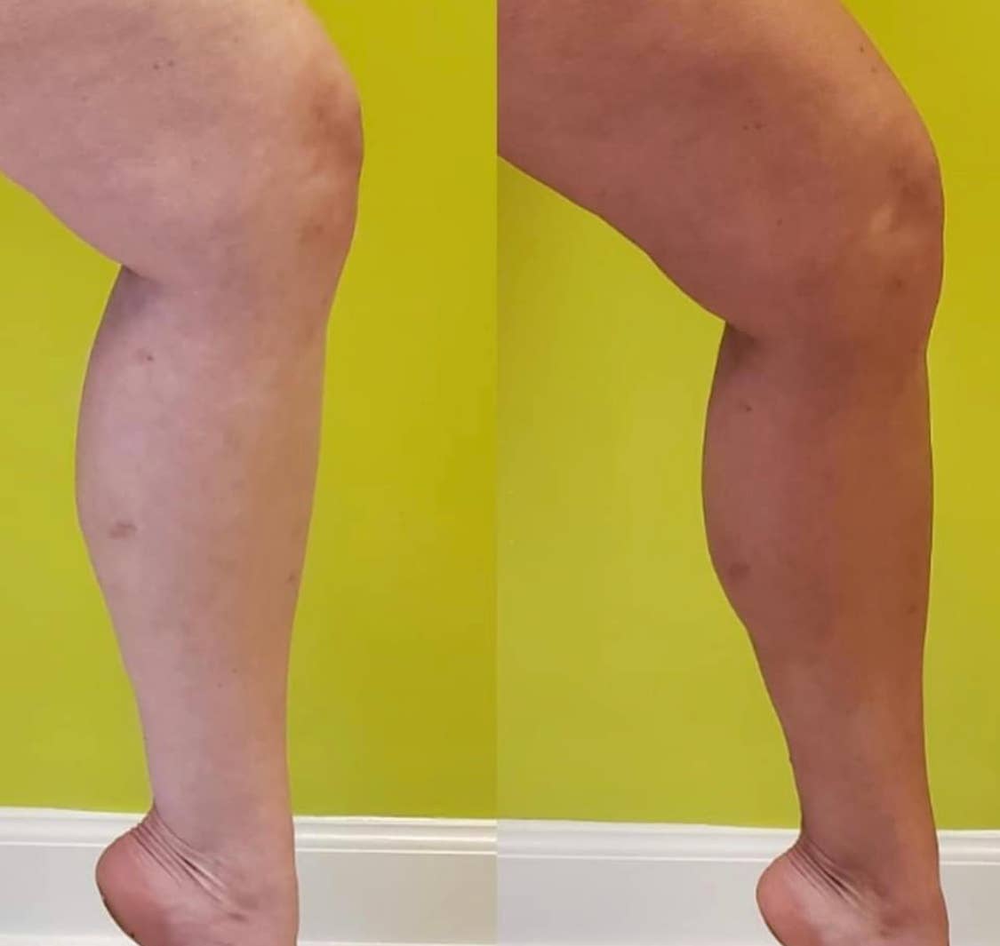 BEETTAN Self Tanning Mousse (Medium-Dark) Beettan LLC