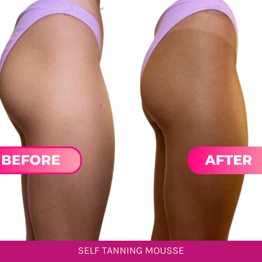 BEETTAN Self Tanning Mousse (Medium-Dark) Beettan LLC